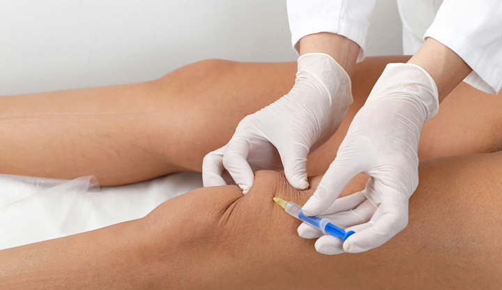 Acheter Prednisolone En Ligne