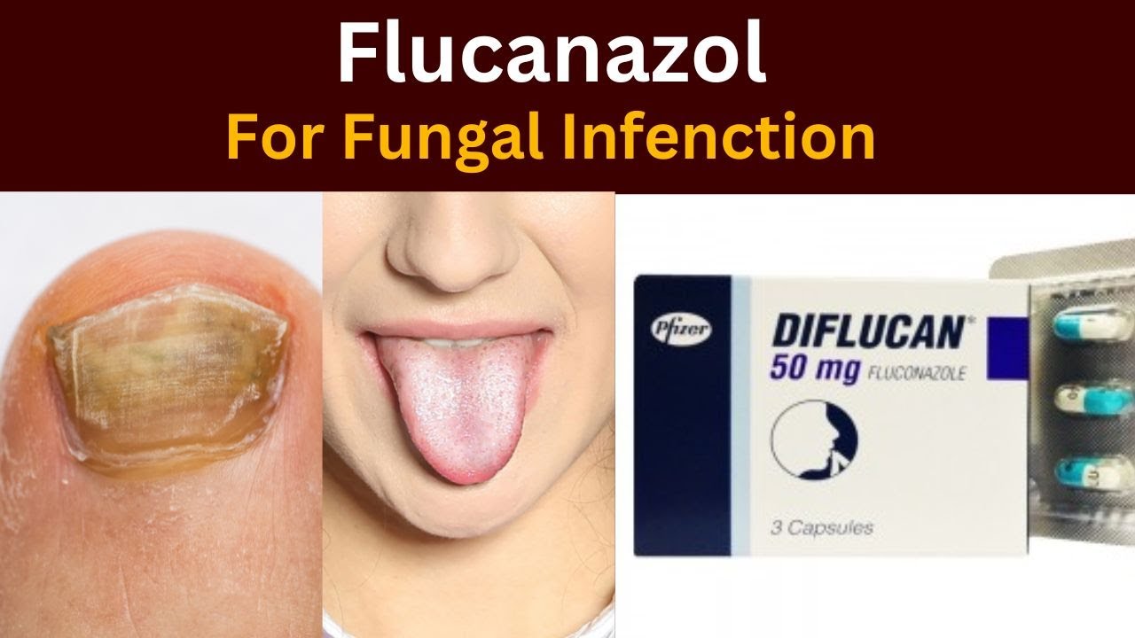 diflucan france acheter