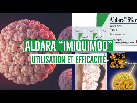 imiquimod prix