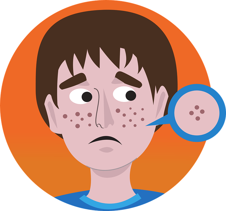 Roaccutane France Acheter
