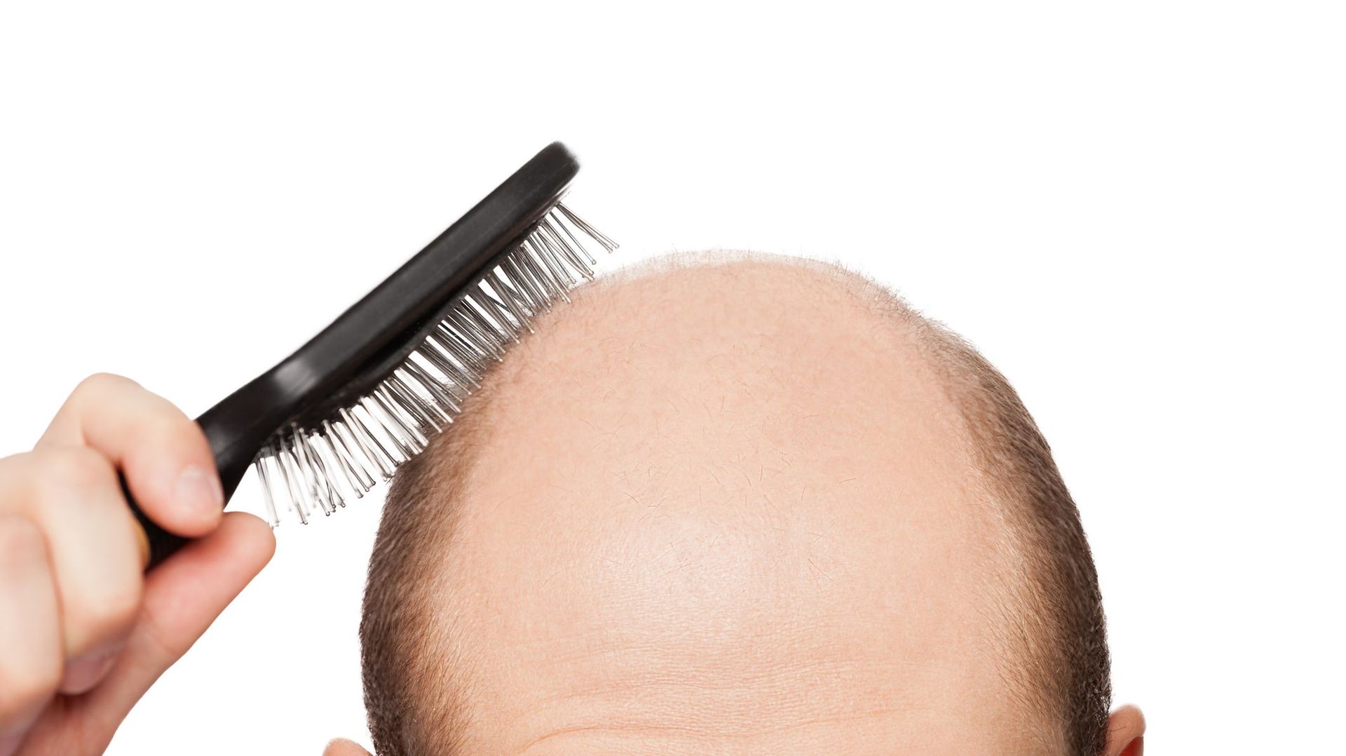 Finasteride 1mg en ligne