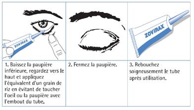 Zovirax Est Il Sans Ordonnance