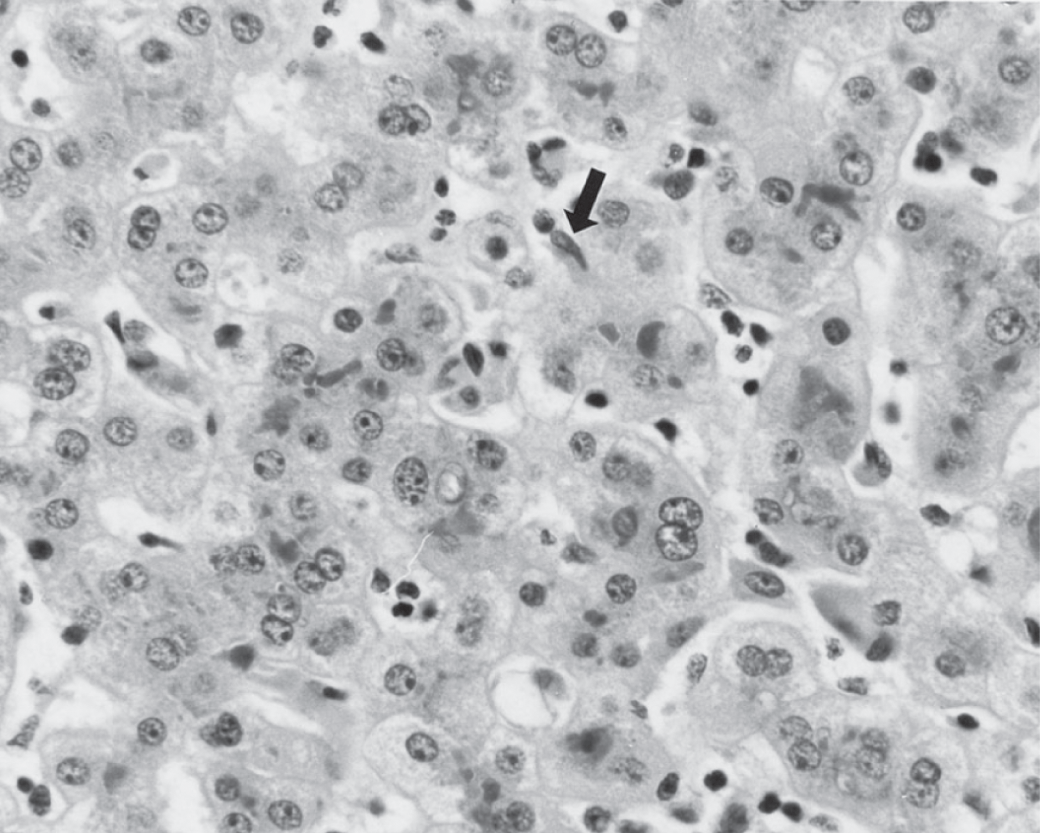 Commander propranolol