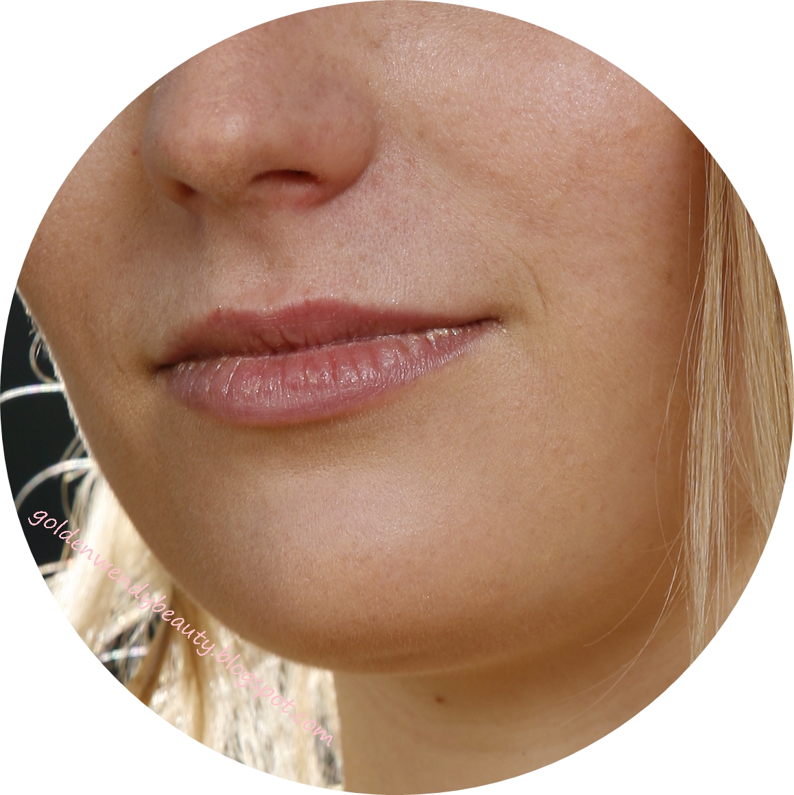 Acheter du roaccutane générique