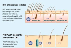 Finasteride générique