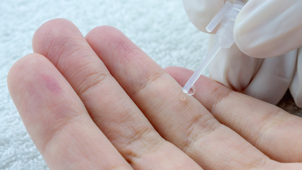 Crème imiquimod sans ordonnance