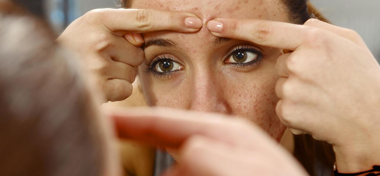 roaccutane sans pillule