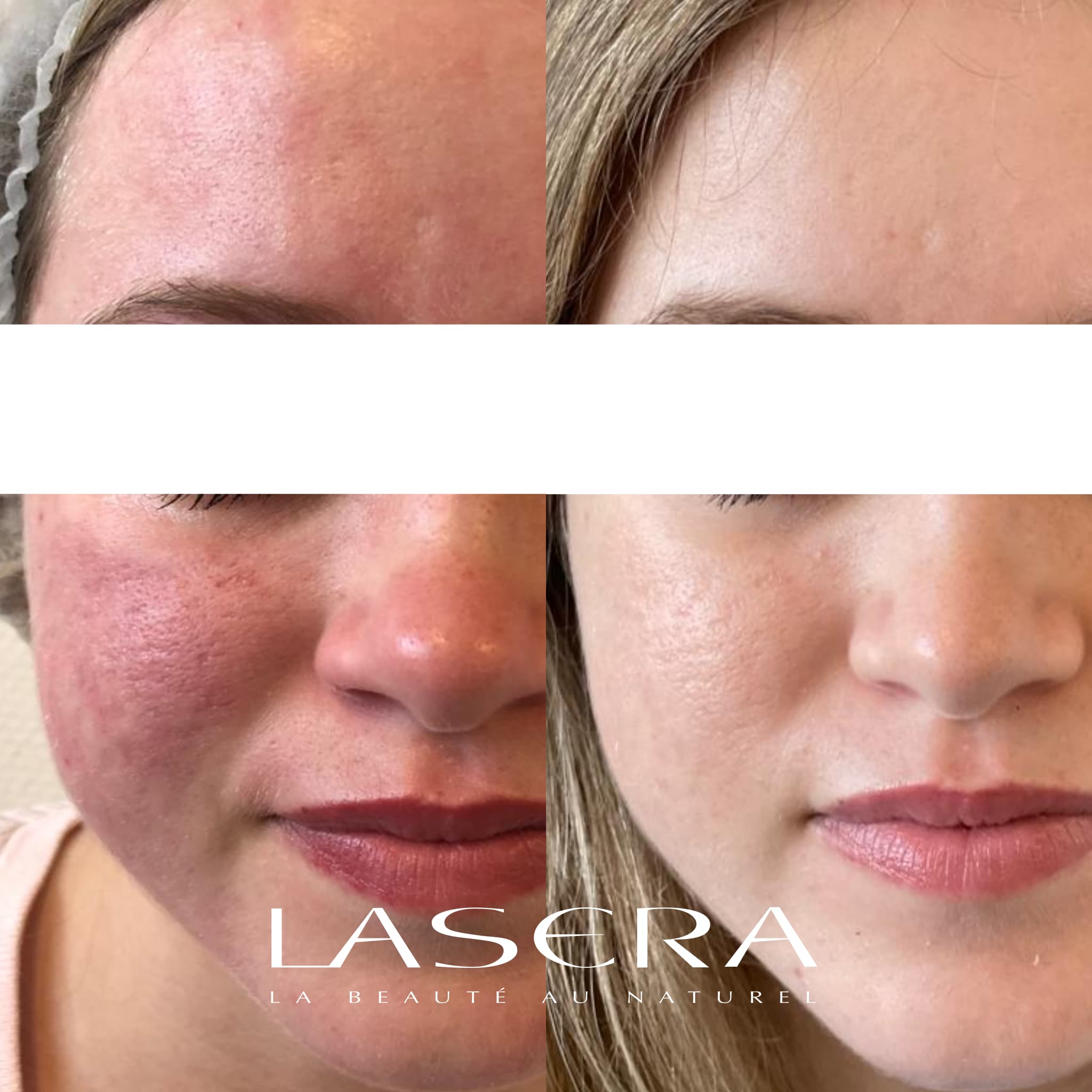 Prix du traitement roaccutane prix du traitement roaccutane