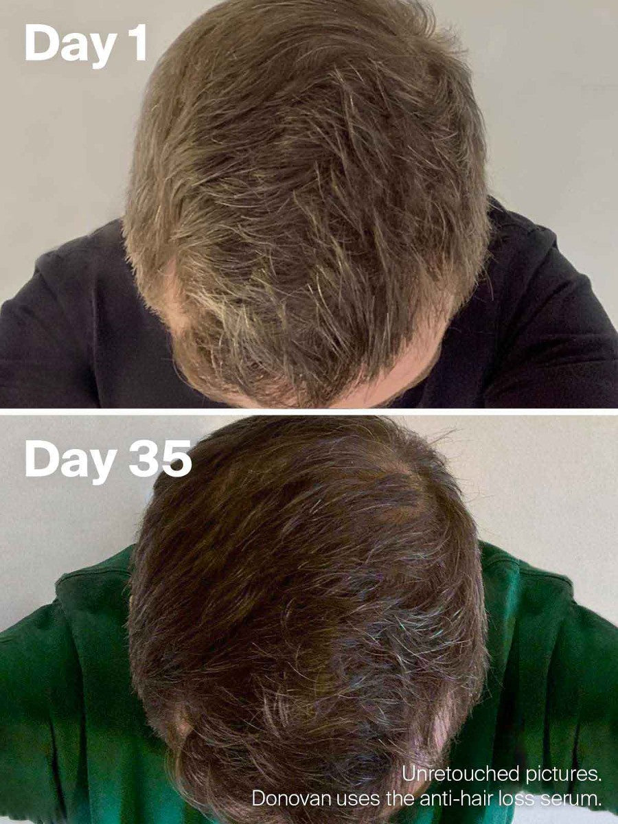 finasteride france prix