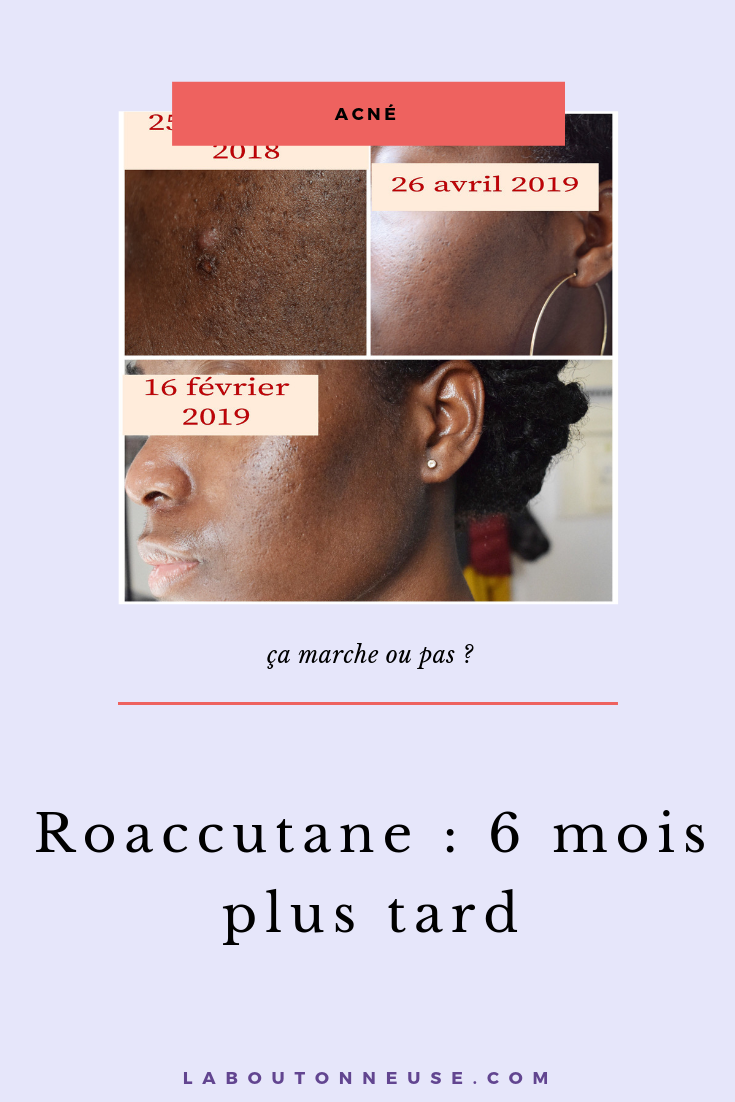 roaccutane acheter ligne