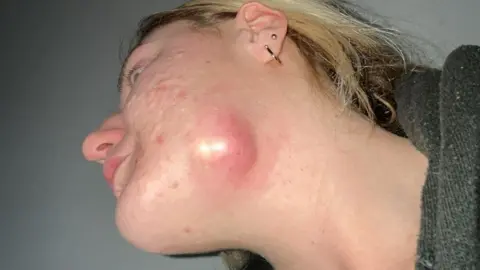 accutane online eu