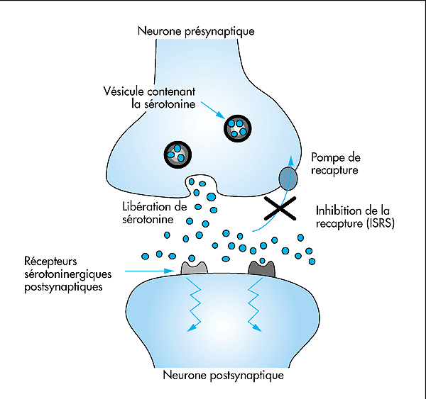 sertraline 100mg avis