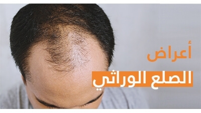 Prix Finasteride