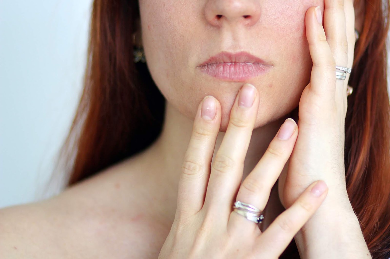 Roaccutane Prix 2020