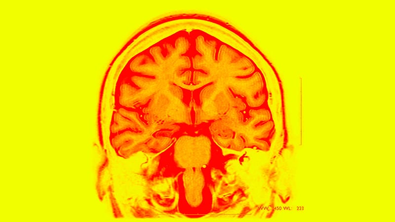 Generique De Clonazepam