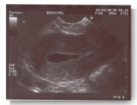 Acheter Clomid Sans Ordonnance En France