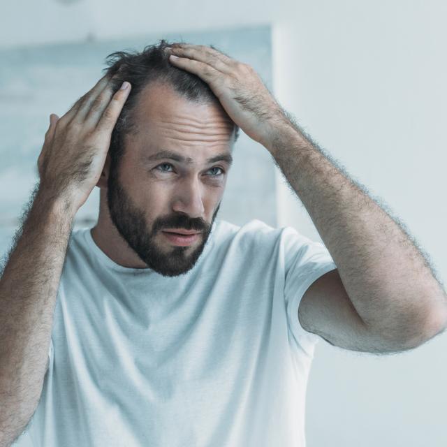 Comment Acheter Du Finpecia
