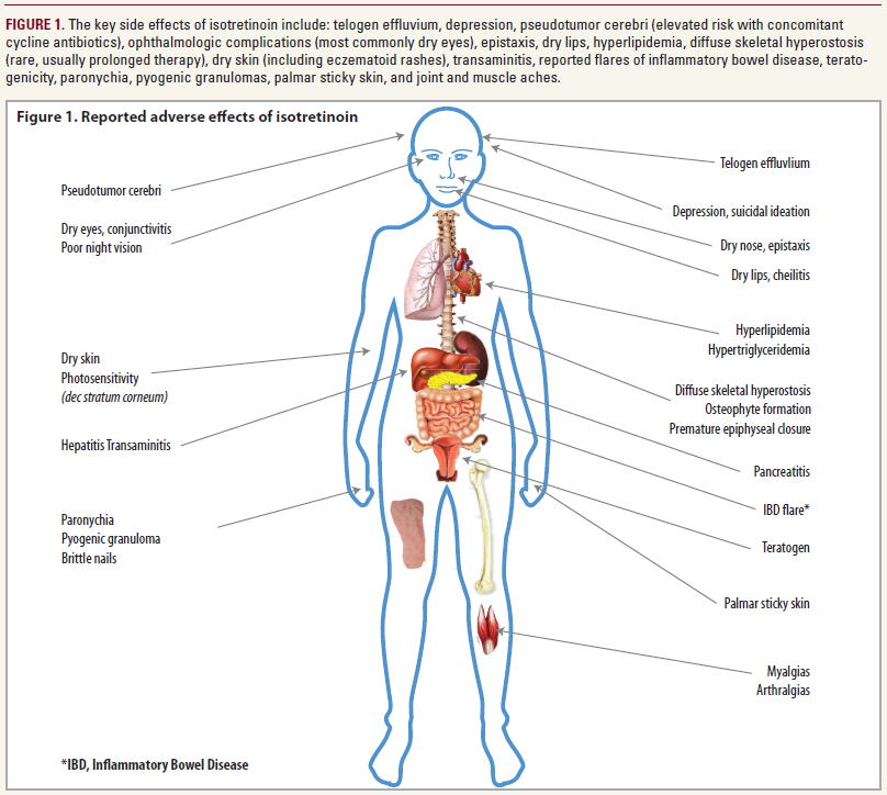 Ordre isotretinoin