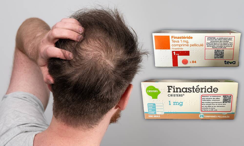 prix finasteride