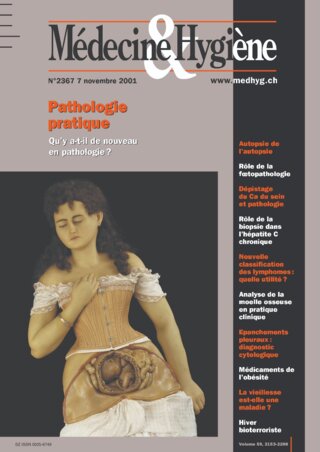 Coût Du Adipex-p