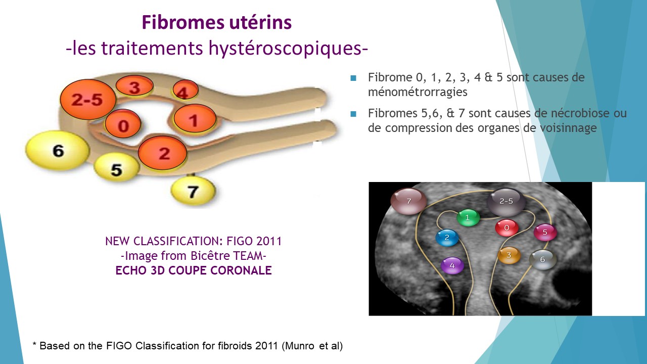 Tamoxifène online