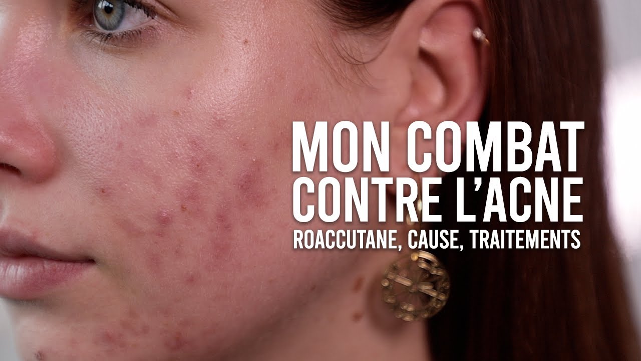 achat roaccutane en ligne