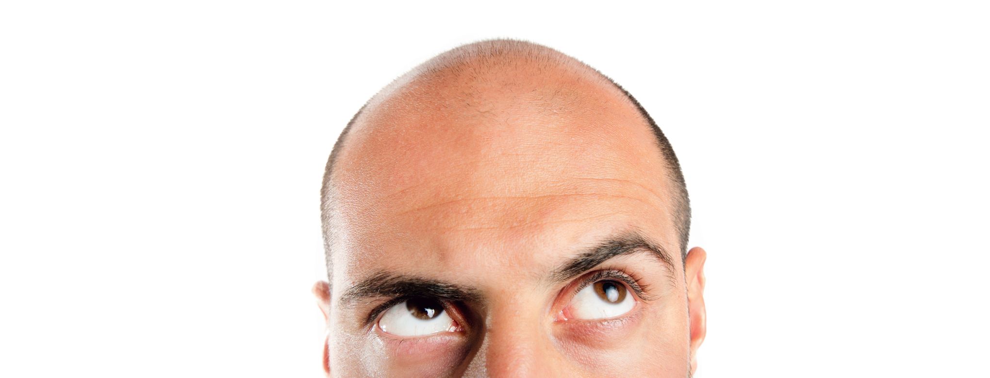 Achat De Finasteride