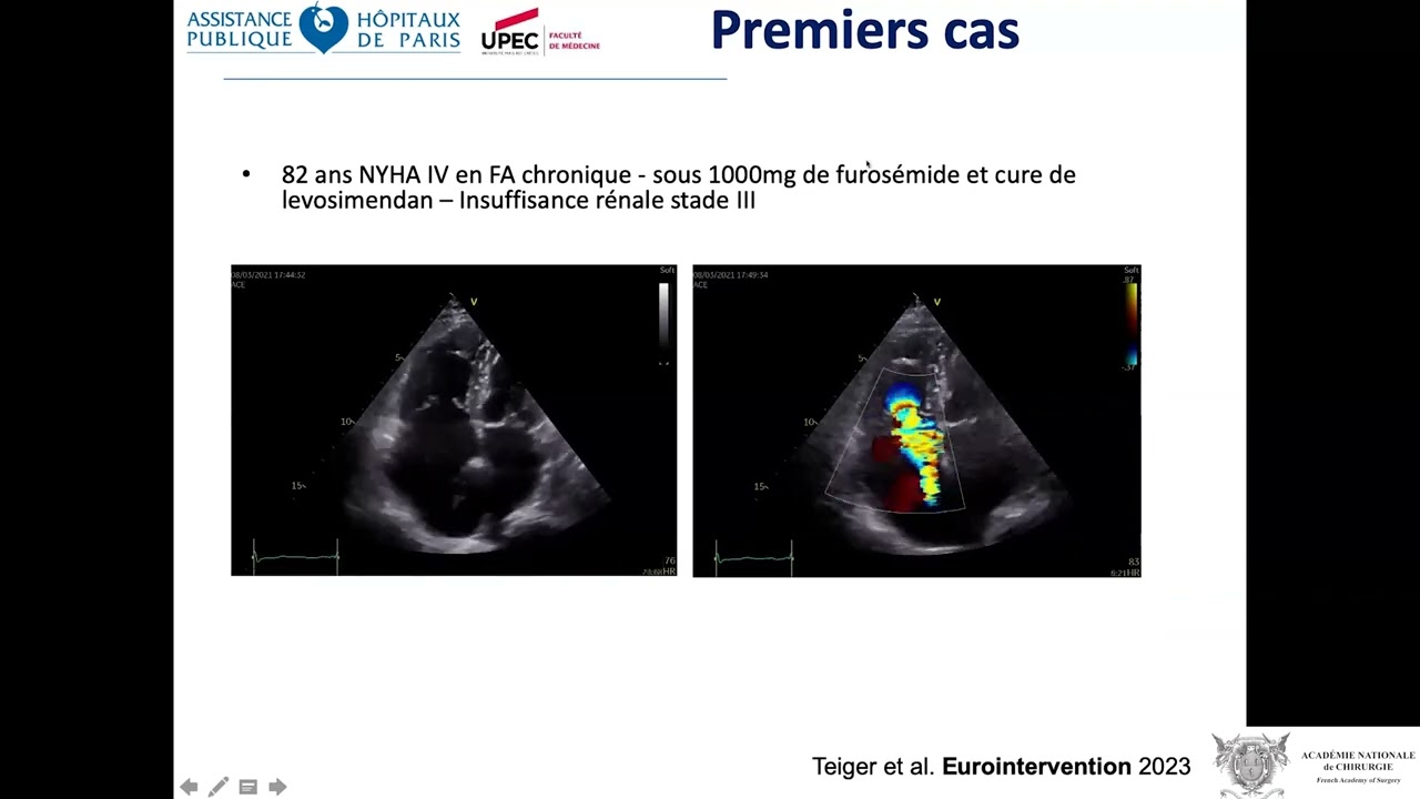 Furosemide Online