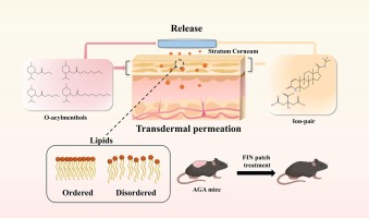Finasteride gel france