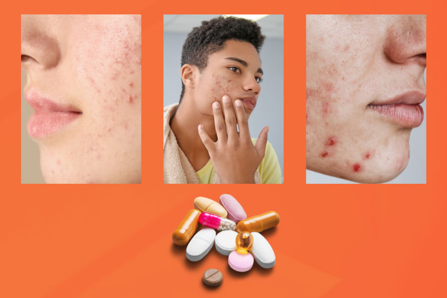 Accutane 5mg online