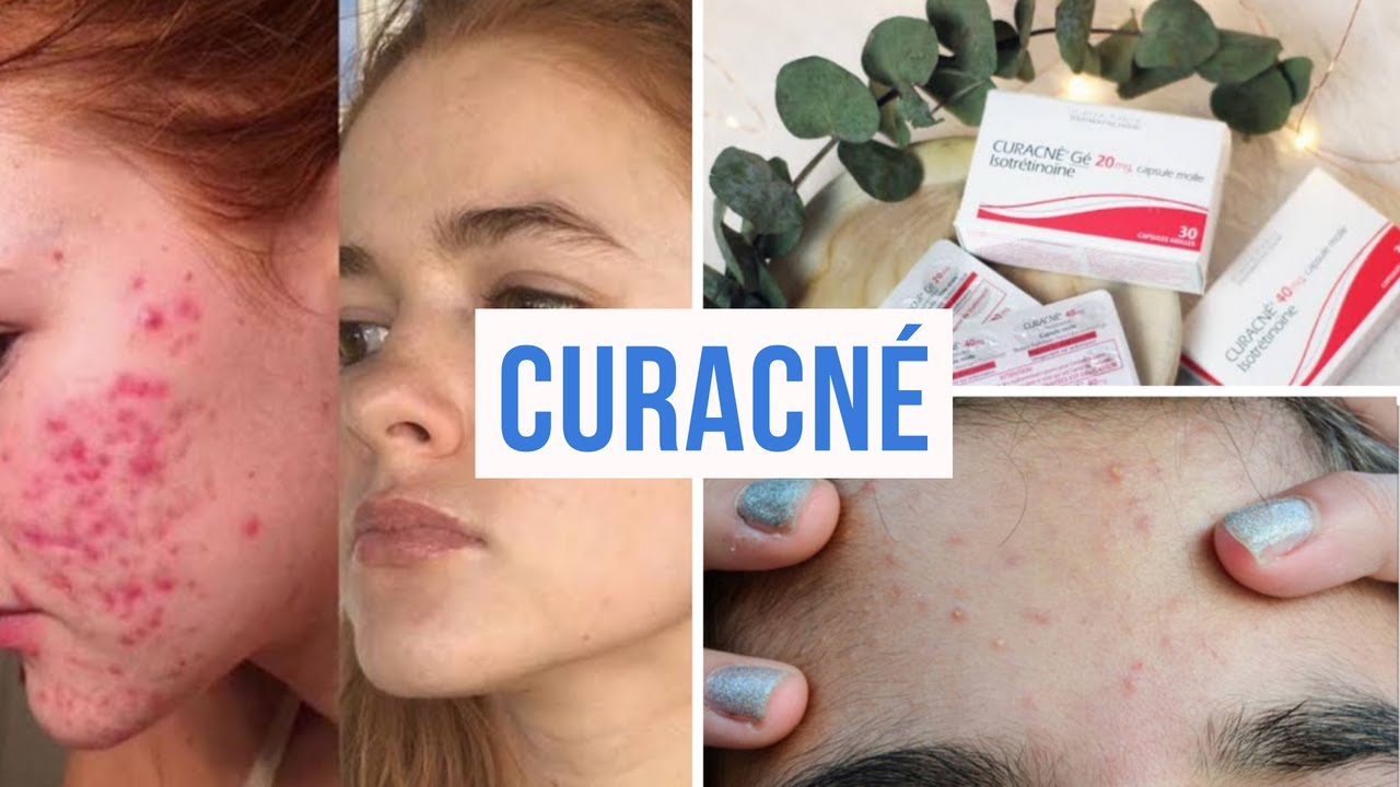 roaccutane prix remboursement