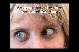 clonazepam online