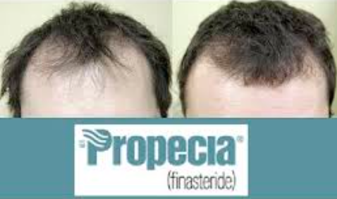 Commander Du Finpecia En Ligne