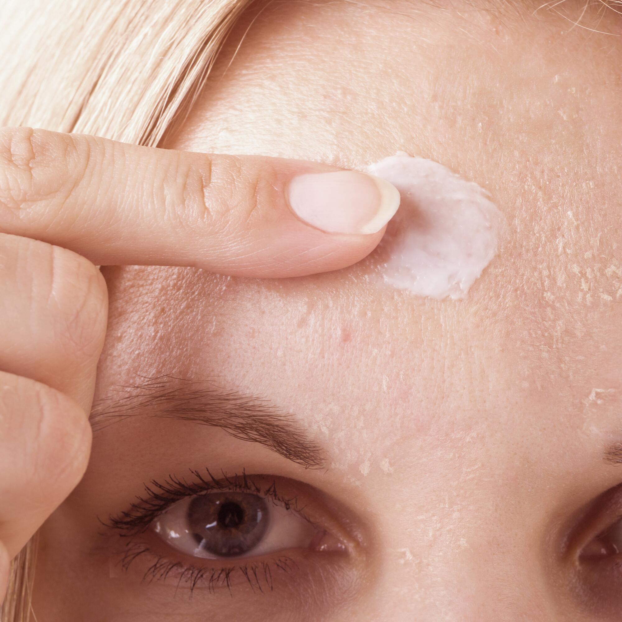Commander isotretinoin en ligne