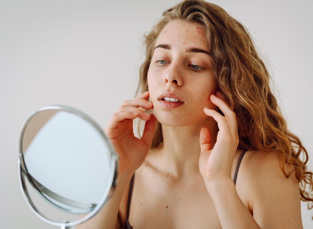 Coût du isotretinoin