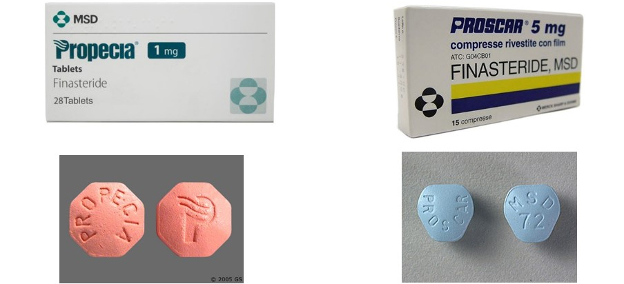 coût finastéride