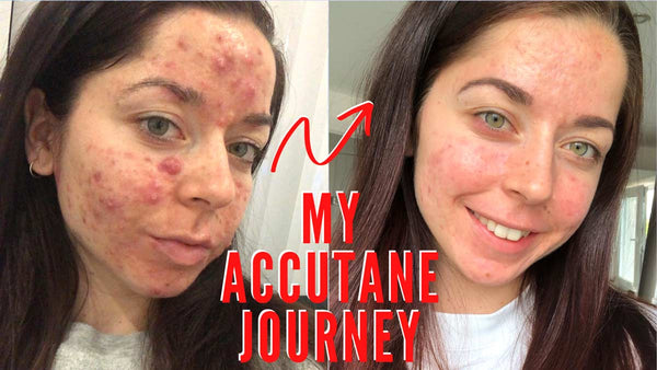 coût isotretinoin