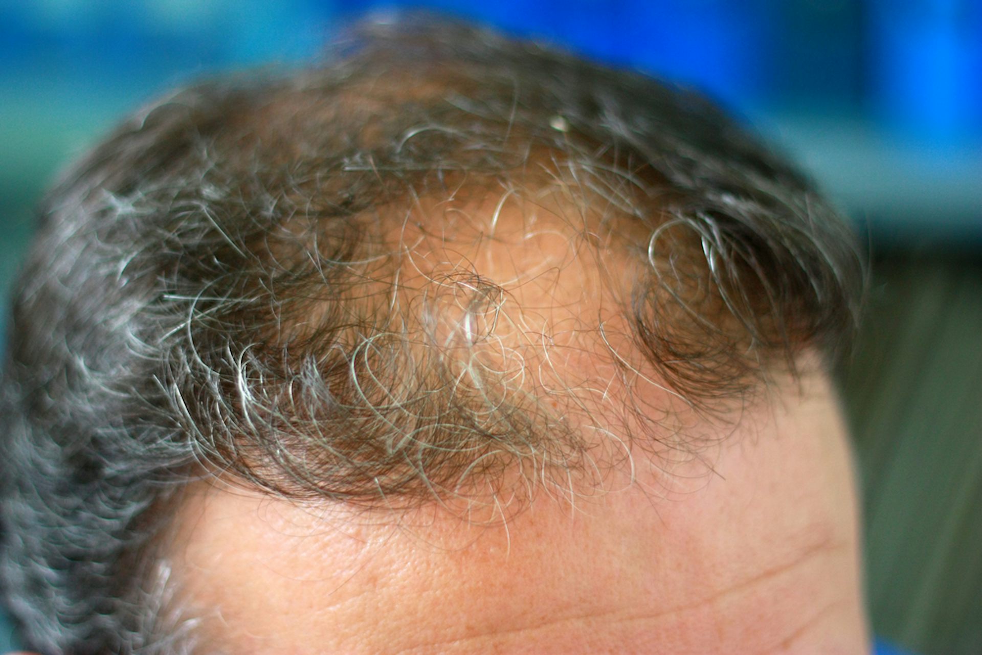 finasteride online