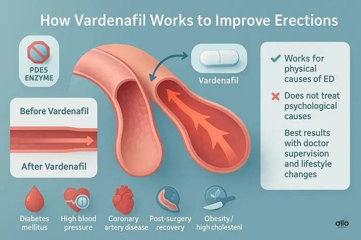 vardenafil 20mg 1mg