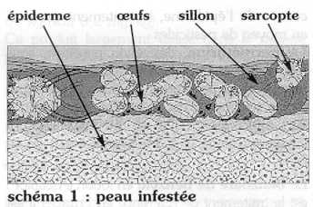ivermectine sans ordonnance luxembourg