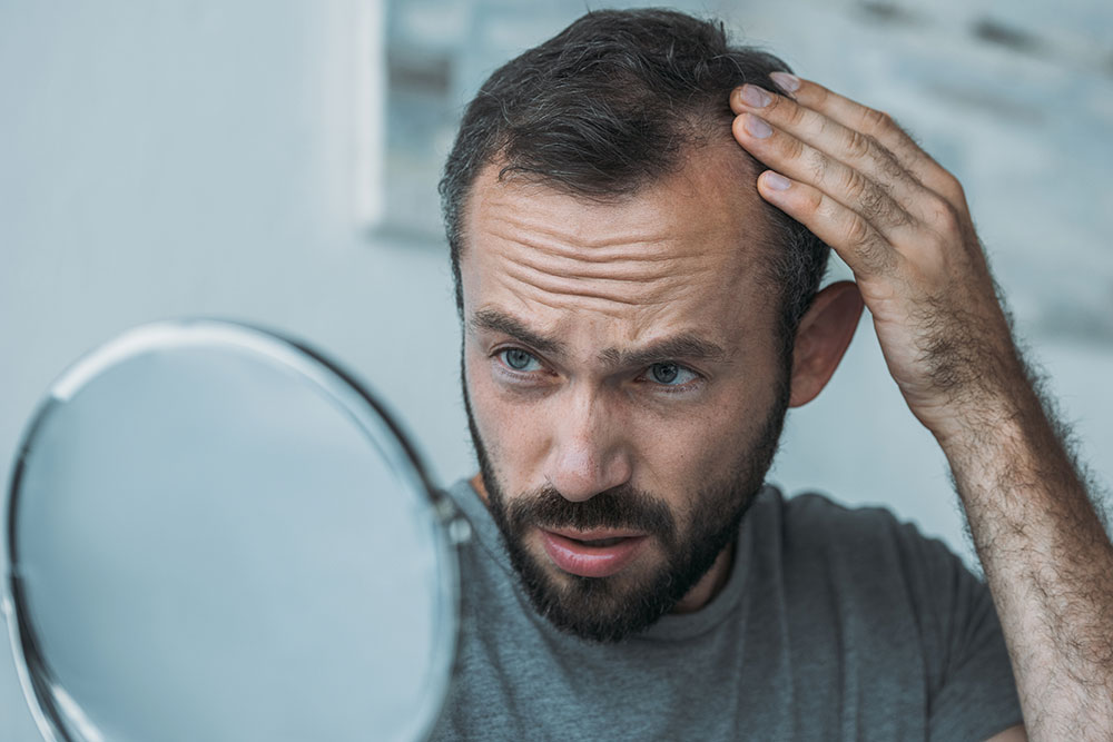 Finasteride Avec Ou Sans Ordonnance
