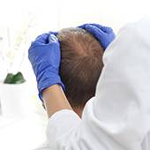 finasteride generique avis