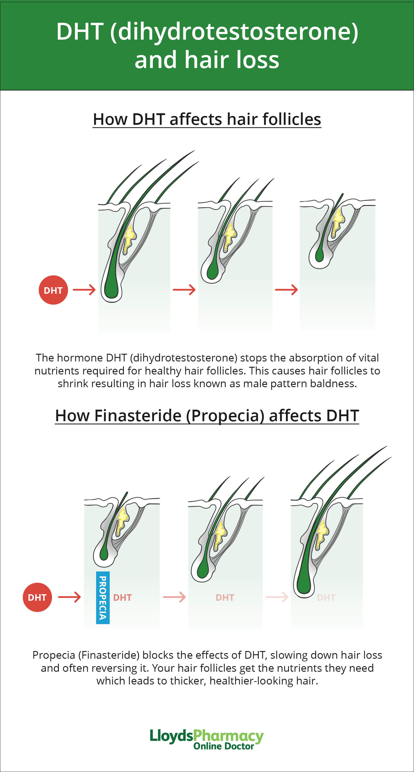 Finasteride propecia online