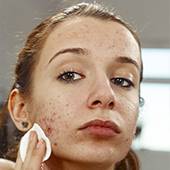 Isotretinoin générique
