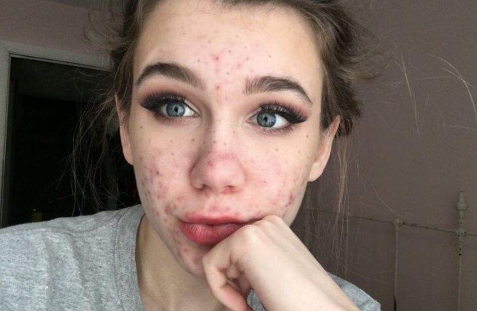 le prix du doxycycline