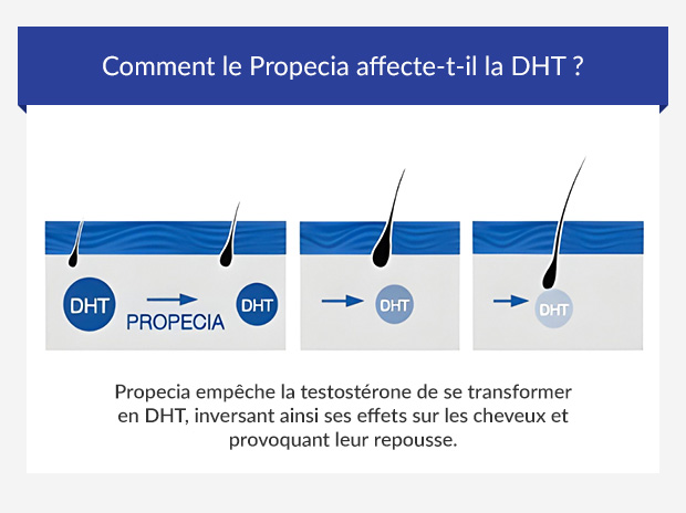 Propecia Où Acheter