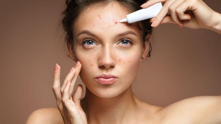 roaccutane sans pilule